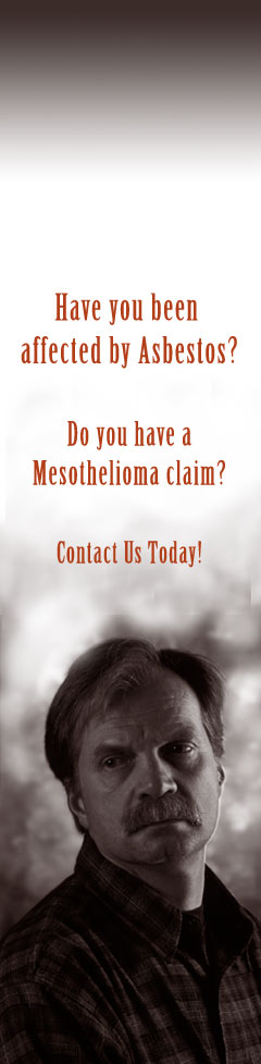 Mesothelioma Attorney Mesothelioma Lawyer Asebstos Lawsuits